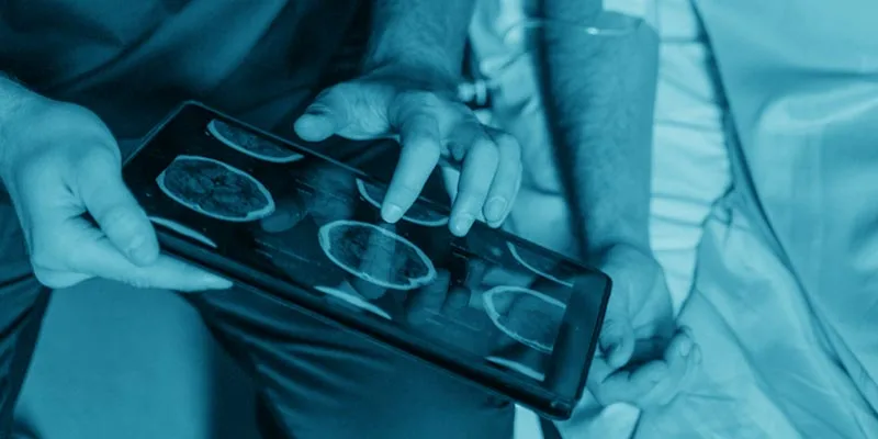 AI Improving Cancer Diagnosis in the NHS Newsletter Image: AI in Healthcare